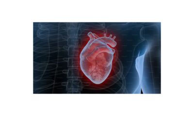 Heart Palpitation Symptoms, Causes, and Treatment